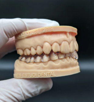 Pròtesi dental al laboratori.