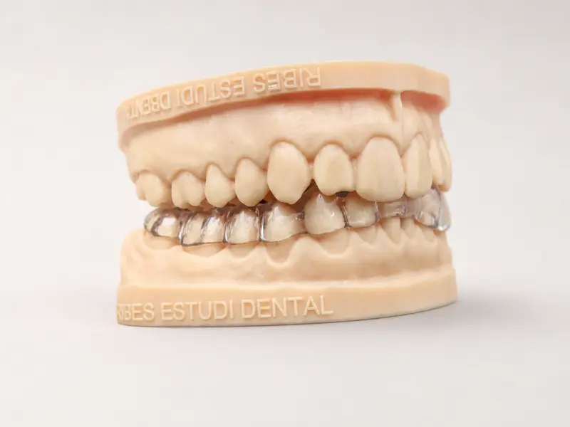 Occlusal splint.